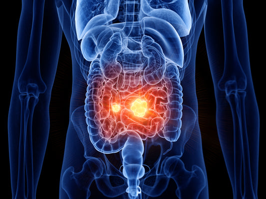 Gut Health: Why It Matters and How to Support It
